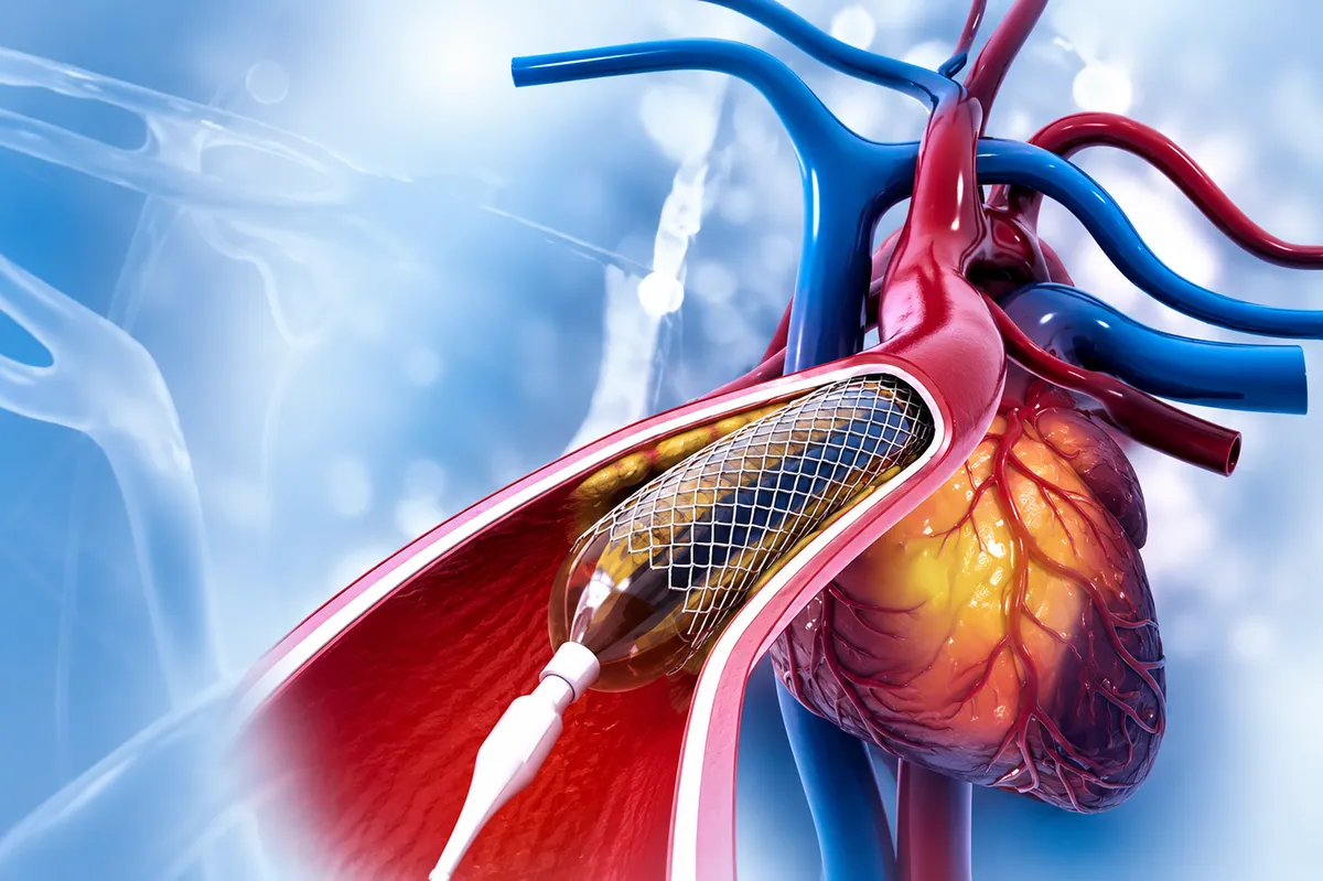 Dr. H. S. Nataraja Setty: Advancing the Frontiers of Interventional Cardiology